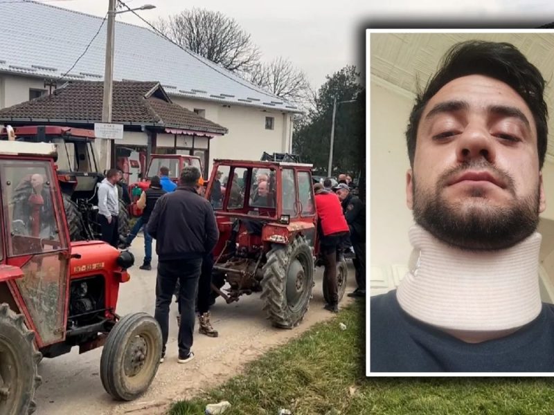“HE SHOUTED THAT WE SHOULD ALL BE KILLED”: SNS supporter brutally beat the organizer of farmer blockades!