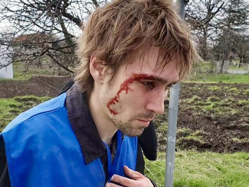 CONFESSION OF A STUDENT BEATEN IN BOR: Masked thugs chased me until I fell into the river, they broke my head, forced me to say “Aca president”!