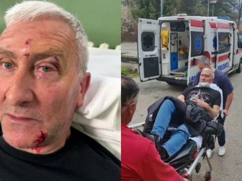 ACTIVIST BEATEN IN THE KOSJERIĆ MUNICIPAL PRESIDENT’S OFFICE: Transported to the hospital with injuries, opposition calls for a protest!