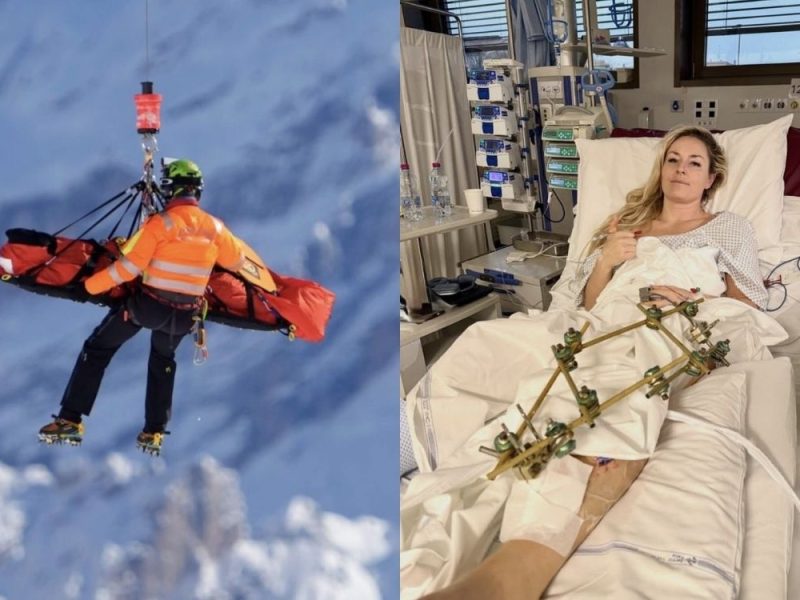 POVREDA LINDZI VON MNOGO GORA NEGO ŠTO SE MISLILO: Legendarnoj skijašici preti amputacija noge!