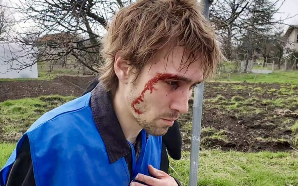 ISPOVEST STUDENTA PRETUČENOG U BORU: Maskirani batinaši su me jurili dok nisam upao u reku, slomili su mi glavu, terali me da kažem „Aca predsednik“!