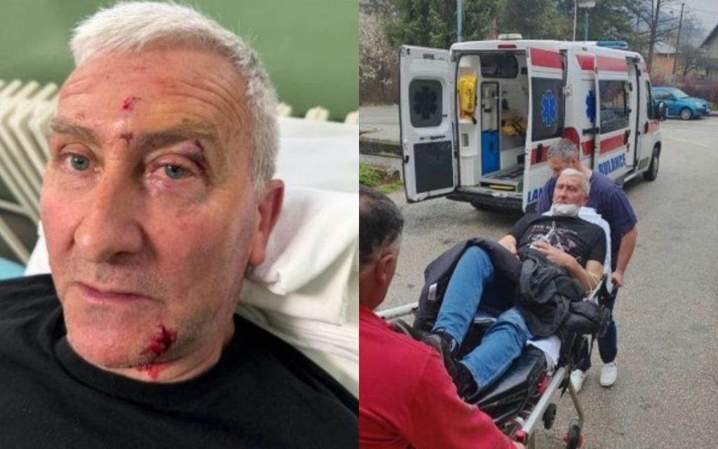AKTIVISTA PRETUČEN U KABINETU PREDSEDNIKA OPŠTINE KOSJERIĆ: Prevezen u bolnicu sa povredama, opozicija pozvala na protest!