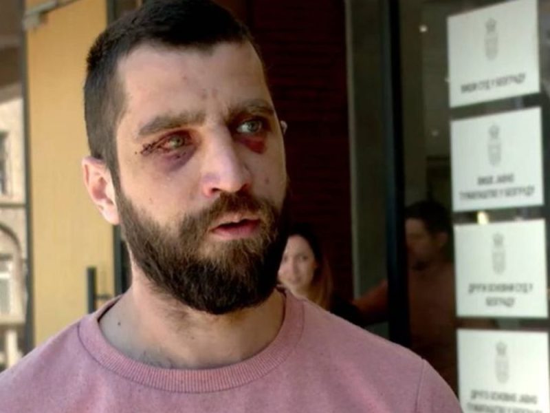 JEZIVA ISPOVEST OTETOG AKTIVISTE IZ RAKOVICE: „Tukli su me i pretili, promenili su priču kada su njihova imena objavljena!“