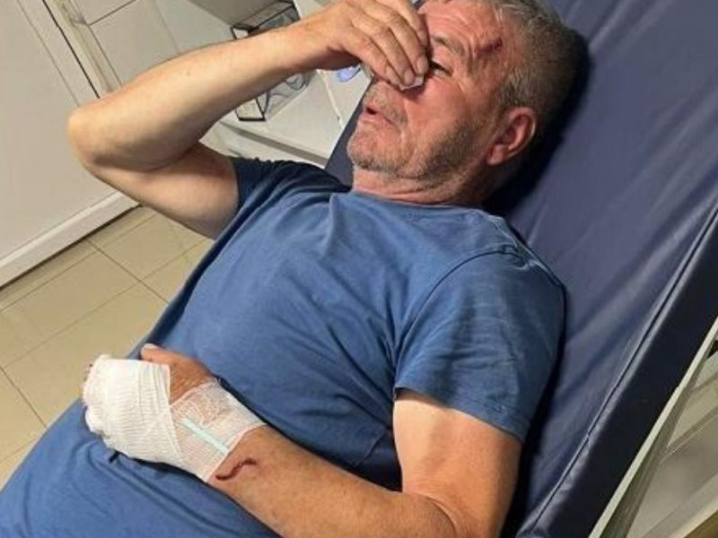 JEZIVO NASILJE U KOSOVSKOM POMORAVLJU: Albanac drvetom brutalno pretukao Srbina koji je skočio da spasi sina!