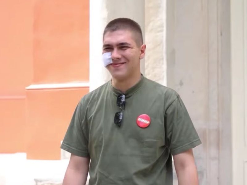 OSLOBOĐEN NIŠKI STUDENT KOGA JE PRETUKLA POLICIJA: Sad on tuži Žandarmeriju za prelome i povrede!