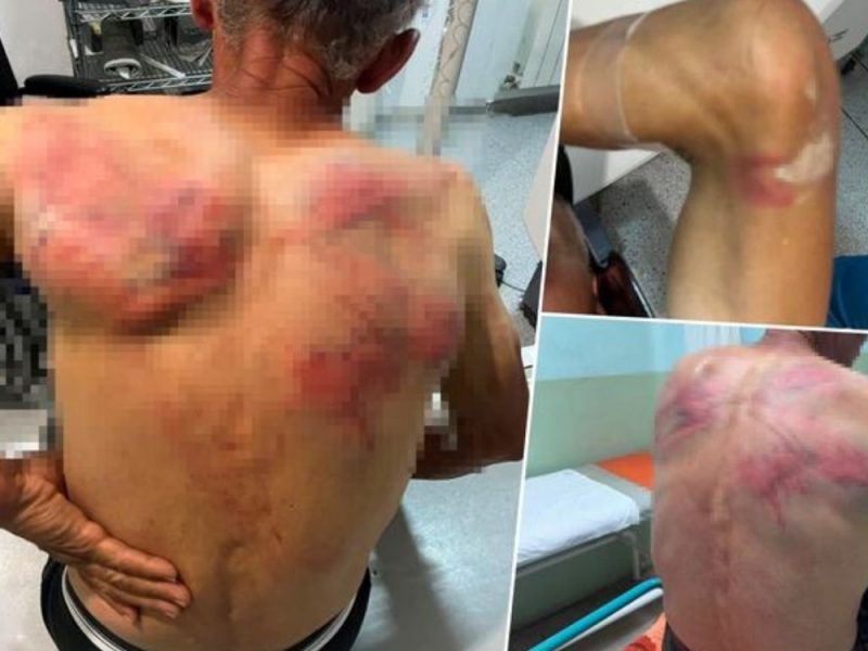 UŽAS U ZUBINOM POTOKU: Tzv. Kosovska policija otela Srbina, slomili mu rebra, terali ga da prizna navodni zločin!