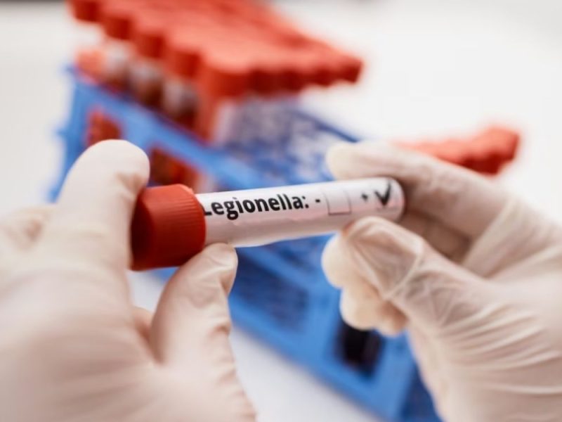 BATERIJA LEGONELA U KLINIČKOM CENTRU VOJVODINE: Tri pacijentkinje zaražene, zatim prebačene u Sremsku Kamenicu!